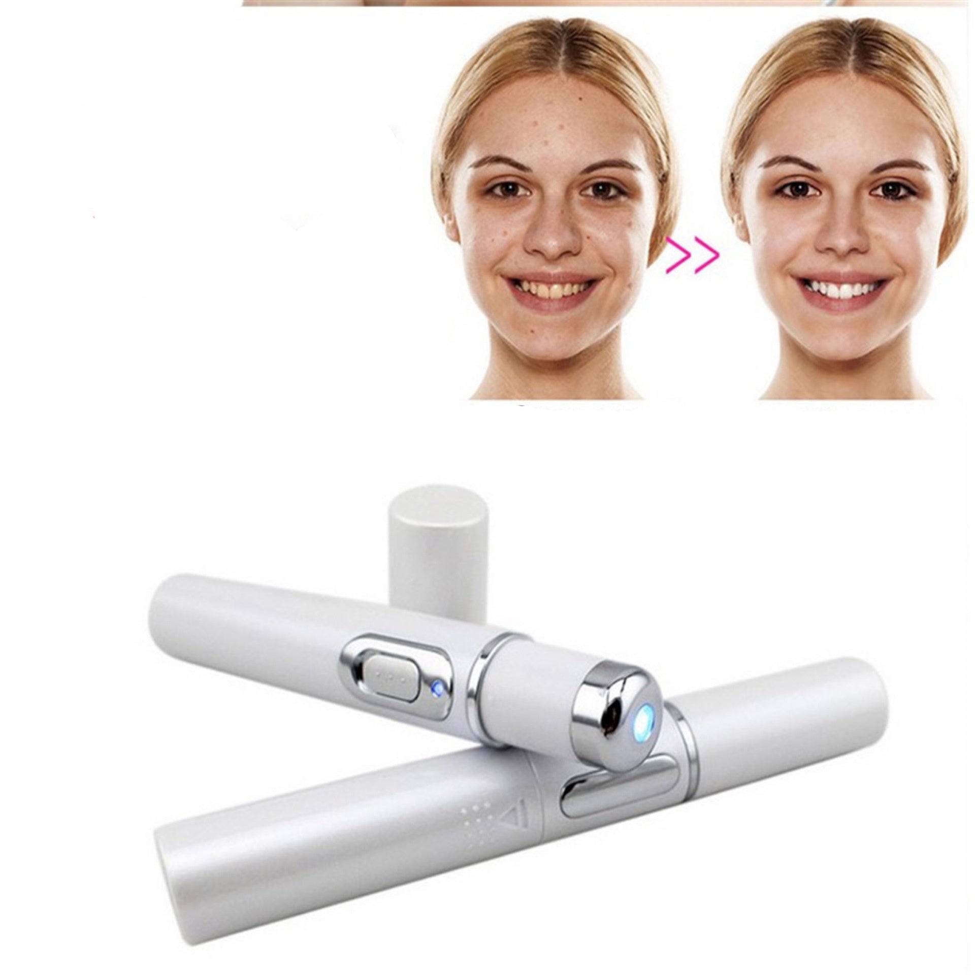 Wrinkle Blemish Pore Acne Scar Remover Pen | LUXETHREAD